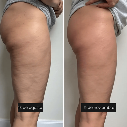 Leggings Moldeadores Anticelulitis 3D